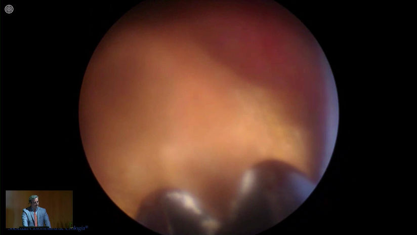 4. Dr. Noberto Bernardo - SEGUNDA CIRUGIA - Sábado